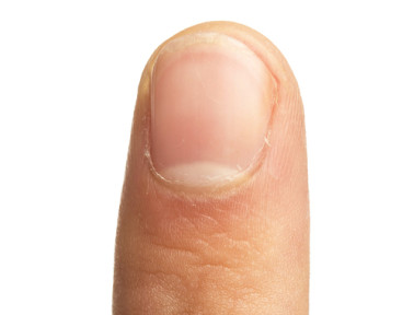 Fingernail Moons