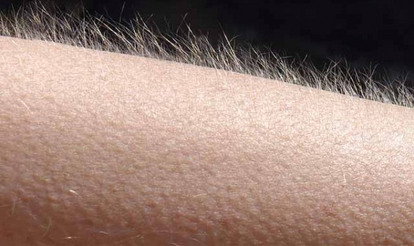 when-you-get-goosebumps-here-s-what-s-really-happening