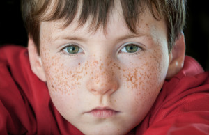 Freckles Image